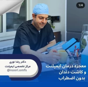 معجزه درمان ایمپلنت و کاشت دندان بدون اضطراب