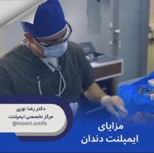 مزایای ایمپلنت دندان