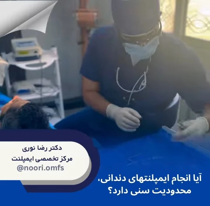 آیا انجام ایمپلنت‌های دندانی محدودیت سنی دارد؟