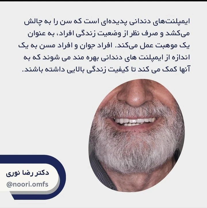 آیا انجام ایمپلنت‌های دندانی محدودیت سنی دارد؟