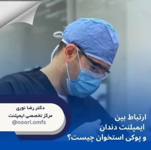 ارتباط بین ایمپلنت دندان و پوکی استخوان چیست؟